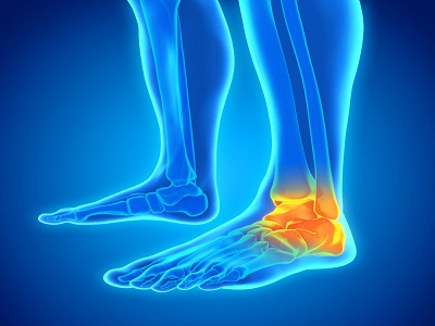 Ankle Pain Treatment